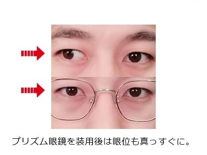 プリズム眼鏡