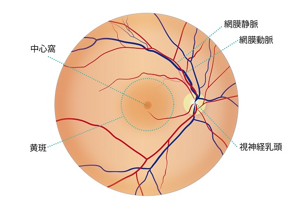 眼底_中心性漿液性脈絡網膜症