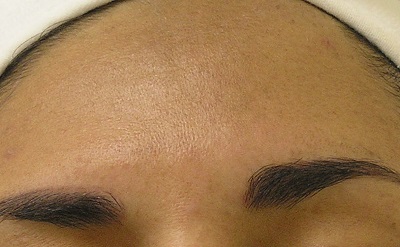 after②