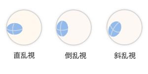 乱視の種類