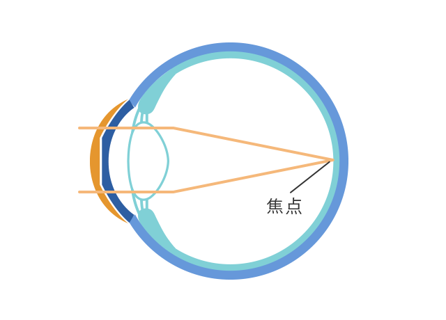 レンズ装用中（就寝中）